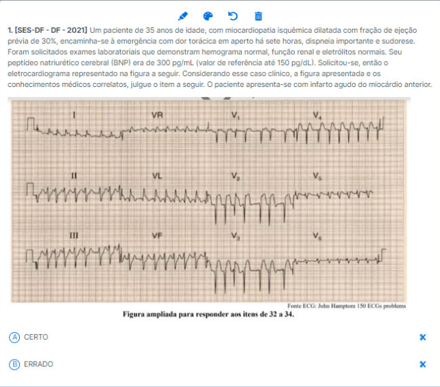 Imagem com uma questão incidente na prova da SES-DF no ano de 2021 solicitando a identificação de um ECG por parte do aluno. 