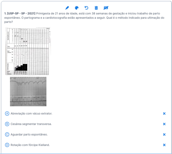 Imagem de questão da USP-SP tratando sobre o assunto de ECG - Questões de prova de Residência Médica