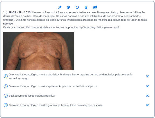 Questão da USP-SP abordando um exame de imagem - Questões de prova de Residência Médica da