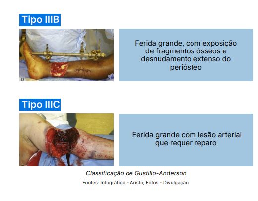 Trauma abdominal tipos 2
